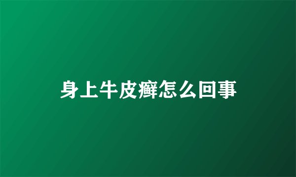 身上牛皮癣怎么回事