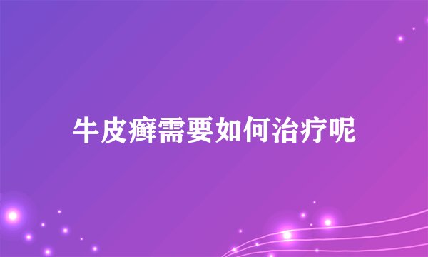 牛皮癣需要如何治疗呢