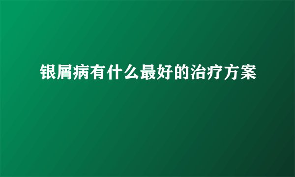银屑病有什么最好的治疗方案
