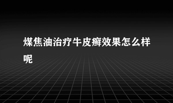煤焦油治疗牛皮癣效果怎么样呢