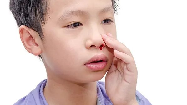 小孩子流鼻血怎么办