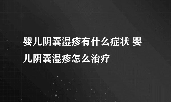婴儿阴囊湿疹有什么症状 婴儿阴囊湿疹怎么治疗