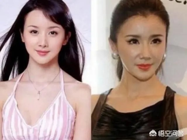 有哪些整容失败的明星?
