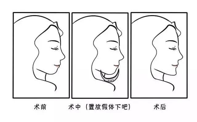柳岩喜欢谁