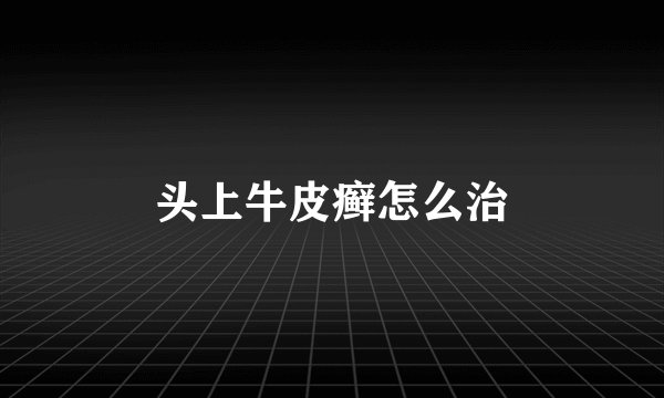 头上牛皮癣怎么治