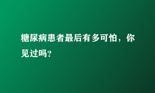 糖尿病患者最后有多可怕，你见过吗？